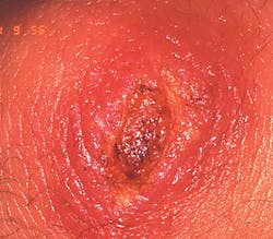 1611rdhcbur P01b 1611rdhcbur P01b