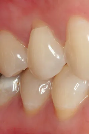 Toothpaste Rda Back Protected by a safe RDA: Setting the record straight about toothpaste ...