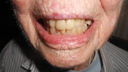 The author thanks Carol Perkins, RDH, BA, who interviewed Verrill and provided images. Carol practices in the San Francisco area. The author thanks Carol Perkins, RDH, BA, who interviewed Verrill and provided images. Carol practices in the San Francisco area.