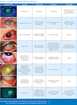 1701rdh 39 1701rdh 39