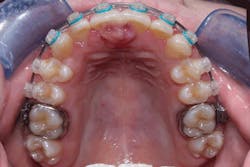 1701rdhcbur P01 1701rdhcbur P01