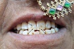 1705rdhcbur P02 1705rdhcbur P02