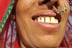 Content Dam Rdh Print Articles Volume37 Issue5 1705rdhcbur P01 Content Dam Rdh Print Articles Volume37 Issue5 1705rdhcbur P01