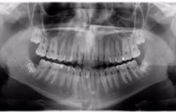 1702rdhcbur P02 1702rdhcbur P02