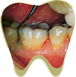 1706rdhfwan P02 1706rdhfwan P02