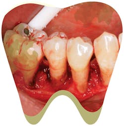 Content Dam Rdh Print Articles Volume37 Issue6 1706rdhfwan P03 Content Dam Rdh Print Articles Volume37 Issue6 1706rdhfwan P03