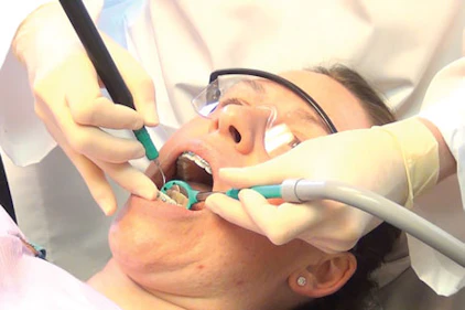 High Volume Evacuation Aerosols It S What You Can T See That Can Hurt You Registered Dental Hygienists