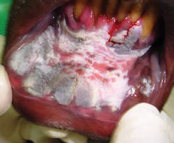 1708rdhcbur P01 1708rdhcbur P01