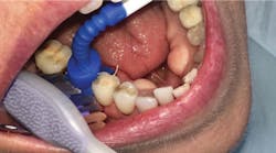 1708rdhcmill P03 1708rdhcmill P03