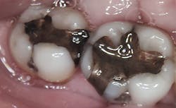 Content Dam Rdh Print Articles Volume37 Issue8 1708rdhfioa P01 Content Dam Rdh Print Articles Volume37 Issue8 1708rdhfioa P01