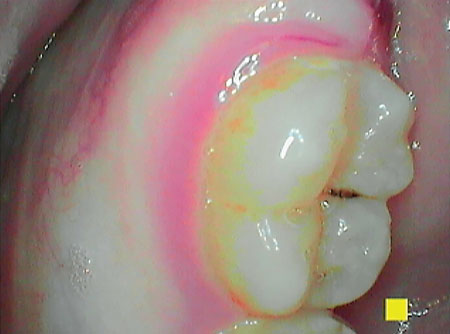 Content Dam Rdh Print Articles Volume37 Issue9 1709rdhcaug P01