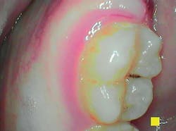 Content Dam Rdh Print Articles Volume37 Issue9 1709rdhcaug P01 Content Dam Rdh Print Articles Volume37 Issue9 1709rdhcaug P01