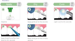 Sfp Hyper Procedure Sfp Hyper Procedure