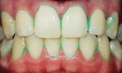 1712rdhfdda P03 1712rdhfdda P03