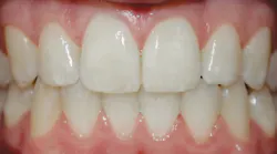 1712rdhfdda P04 1712rdhfdda P04