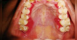 1801rdhcbur P01 1801rdhcbur P01