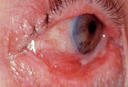 1801rdhcbur P03 1801rdhcbur P03