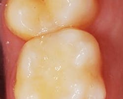 1801rdhfgol P03c 1801rdhfgol P03c