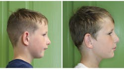 1804rdhfomt P01 1804rdhfomt P01