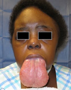 1810rdhbur P02 1810rdhbur P02