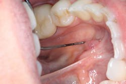 1810rdhpth P01 1810rdhpth P01