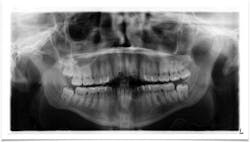 1810rdhpth P03 1810rdhpth P03