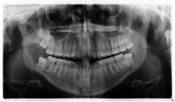 1810rdhpth P04 1810rdhpth P04