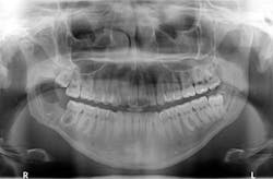 1810rdhpth P05 1810rdhpth P05