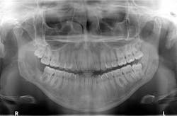 1810rdhpth P06 1810rdhpth P06