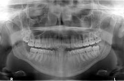 1810rdhpth P07 1810rdhpth P07