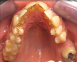 1811rdhgue P03 1811rdhgue P03