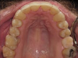 1811rdhgue P04 1811rdhgue P04