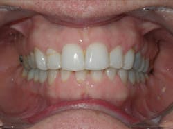 1811rdhgue P06 1811rdhgue P06