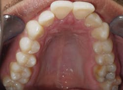 1811rdhgue P09 1811rdhgue P09