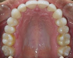 1811rdhgue P10 1811rdhgue P10