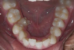 1811rdhgue P11 1811rdhgue P11