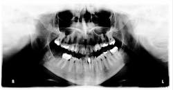 1812rdhcol P01 1812rdhcol P01