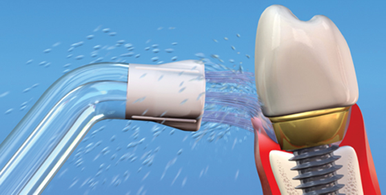 Content Dam Diq Slideshow 2014 07 1309rdhfwgv1