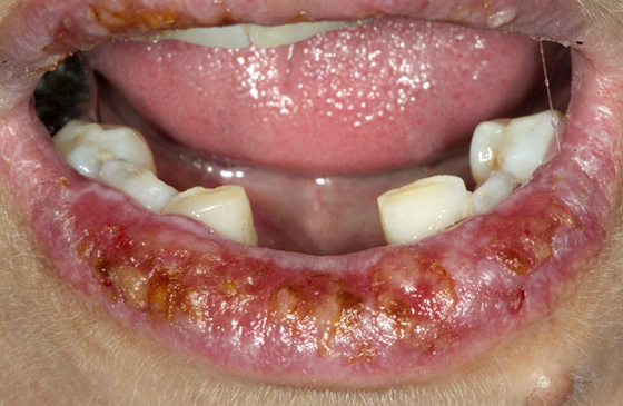 Content Dam Diq Slideshow 2014 07 Lp Lip Pre Tx 1