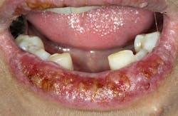 Content Dam Diq Slideshow 2014 07 Lp Lip Pre Tx 1 Content Dam Diq Slideshow 2014 07 Lp Lip Pre Tx 1