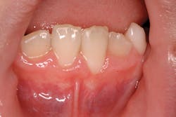 1902rdhbur P01 1902rdhbur P01