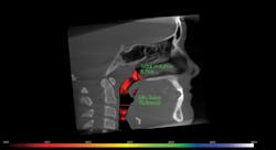 1902rdhroy P05 1902rdhroy P05