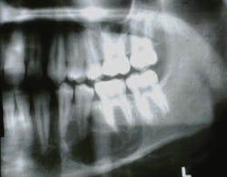 1903rdhbur P01 1903rdhbur P01