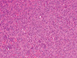 1903rdhbur P02 1903rdhbur P02