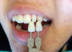 Content Dam Rdh En Articles Print Volume 36 Issue 8 Contents Oral Lesion Documentation Leftcolumn Article Thumbnailimage File Content Dam Rdh En Articles Print Volume 36 Issue 8 Contents Oral Lesion Documentation Leftcolumn Article Thumbnailimage File