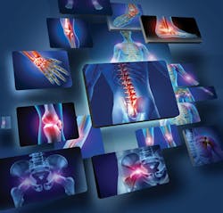 Content Dam Rdh En Articles Print Volume 37 Issue 3 Contents Turning The Heat Down On Inflammation Leftcolumn Article Thumbnailimage File Content Dam Rdh En Articles Print Volume 37 Issue 3 Contents Turning The Heat Down On Inflammation Leftcolumn Article Thumbnailimage File