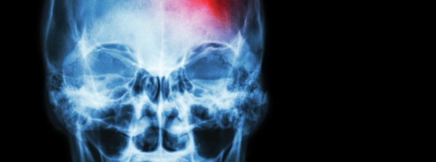 Content Dam Rdh En Articles Print Volume 38 Issue 2 Content Dam Was It Something I Said Leftcolumn Article Thumbnailimage File