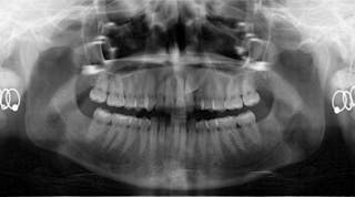 Content Dam Rdh En Articles Slideshows 2014 08 Dental Photo Of The Day 23 Leftcolumn Article Thumbnailimage File