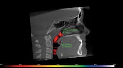 Content Dam Rdh Print Articles Volume 39 Issue 2 1902rdhroy Thumb Content Dam Rdh Print Articles Volume 39 Issue 2 1902rdhroy Thumb