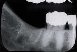 1904rdhbur P01 1904rdhbur P01